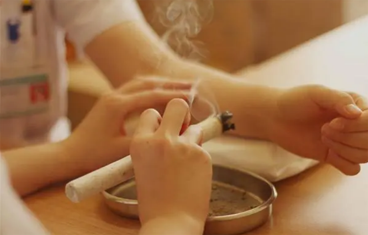 Cứu điều trị liệt chi trên (liệt một chi trên) (Chứng nuy; Chứng kính)